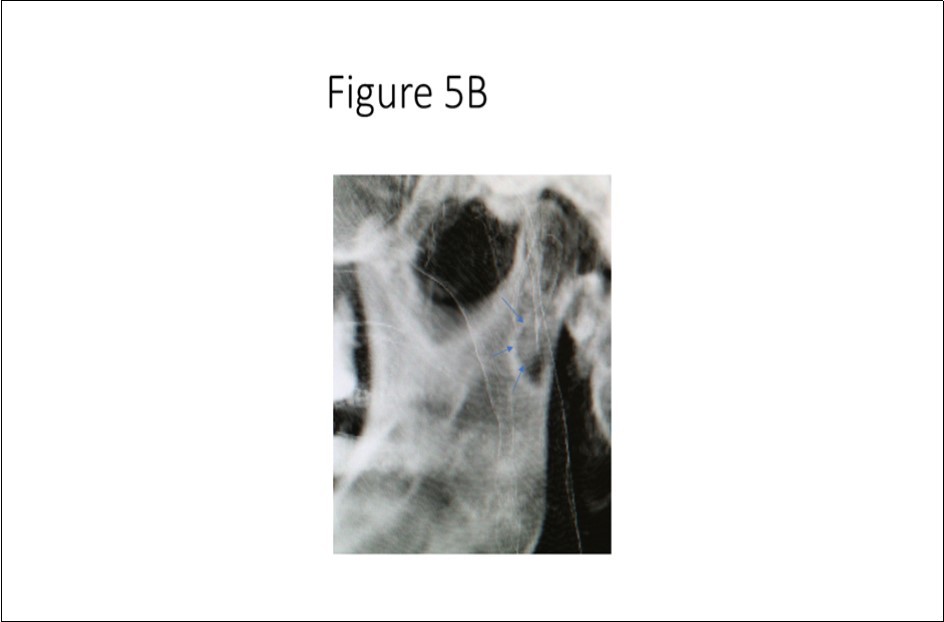 Figure 5B.
