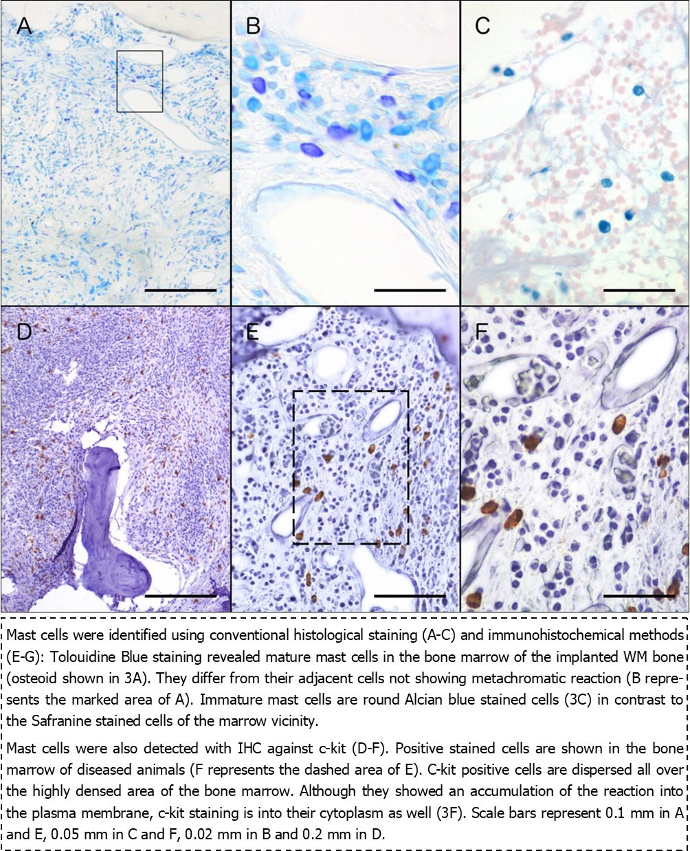  Histological (A-C) and immunohistochemical (D-F) staining of mast cells in WM biopsies.
